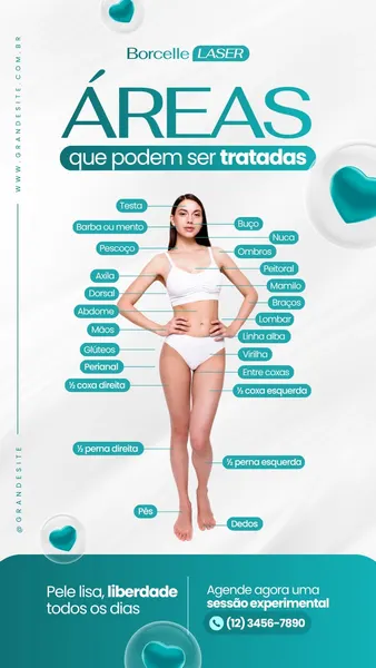 Template de Story para Instagram com fundo branco e detalhes em azul turquesa. Uma mulher em traje de banho está no centro, com linhas apontando para diversas áreas do corpo, como rosto, axilas, pernas e braços, indicando tratamentos possíveis. O texto principal diz 'Áreas que podem ser tratadas'.