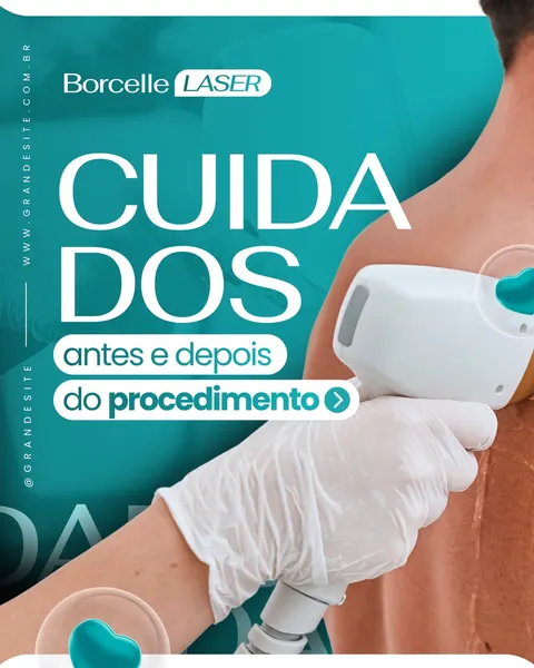 Close-up de uma mão com luva branca segurando um aparelho de depilação a laser, com o texto 'Cuidados antes e depois do procedimento' em destaque. O fundo é azul-petróleo com detalhes brancos, sugerindo um ambiente clínico de estética moderno.