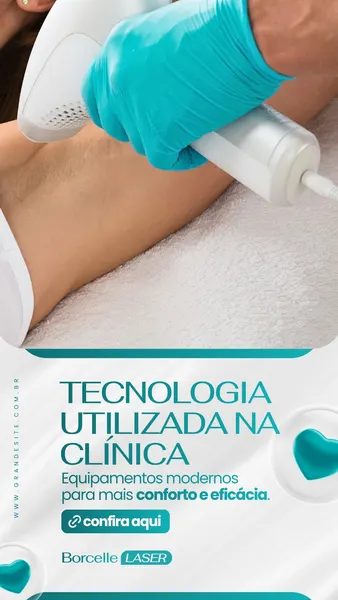 Close-up de um profissional de estética usando um aparelho de depilação a laser em uma cliente. O template destaca o texto 'Tecnologia Utilizada Na Clínica' e 'Equipamentos modernos para mais conforto e eficácia', em tons de azul e branco, com ícones de coração.